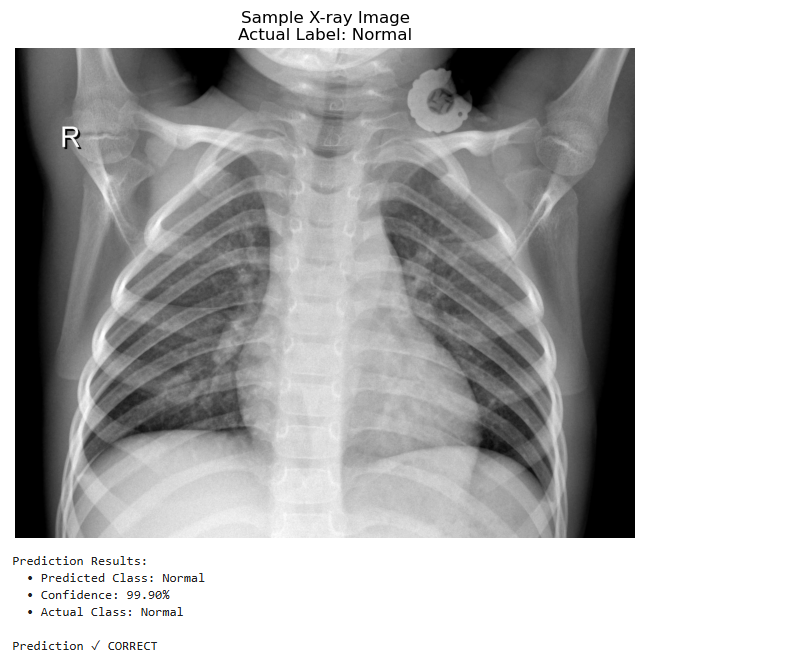 COVID-19 Chest X-ray Detection